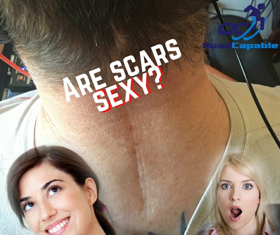 Are scars sexy quadriplegic gaming living with paralysis